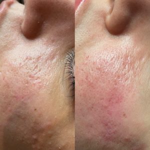 The Glow Spot - Beauty specialist Utrecht - Wimpers, wenkbrauwen, visagie etc